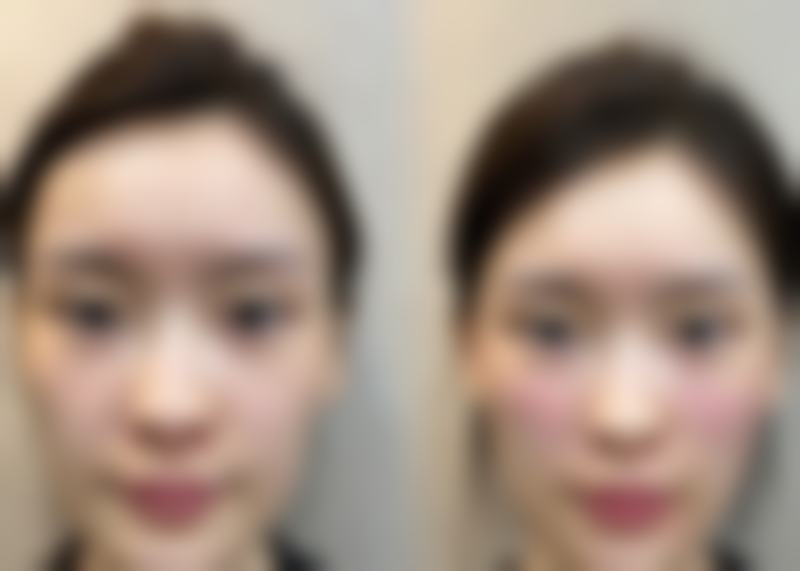 重庆爱思特整形美容医院刘珍茂医生预约挂号指南