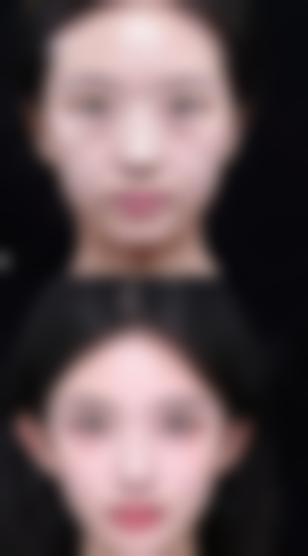 成都悦丽美科医疗美容诊所涂宇腾医生擅长项目