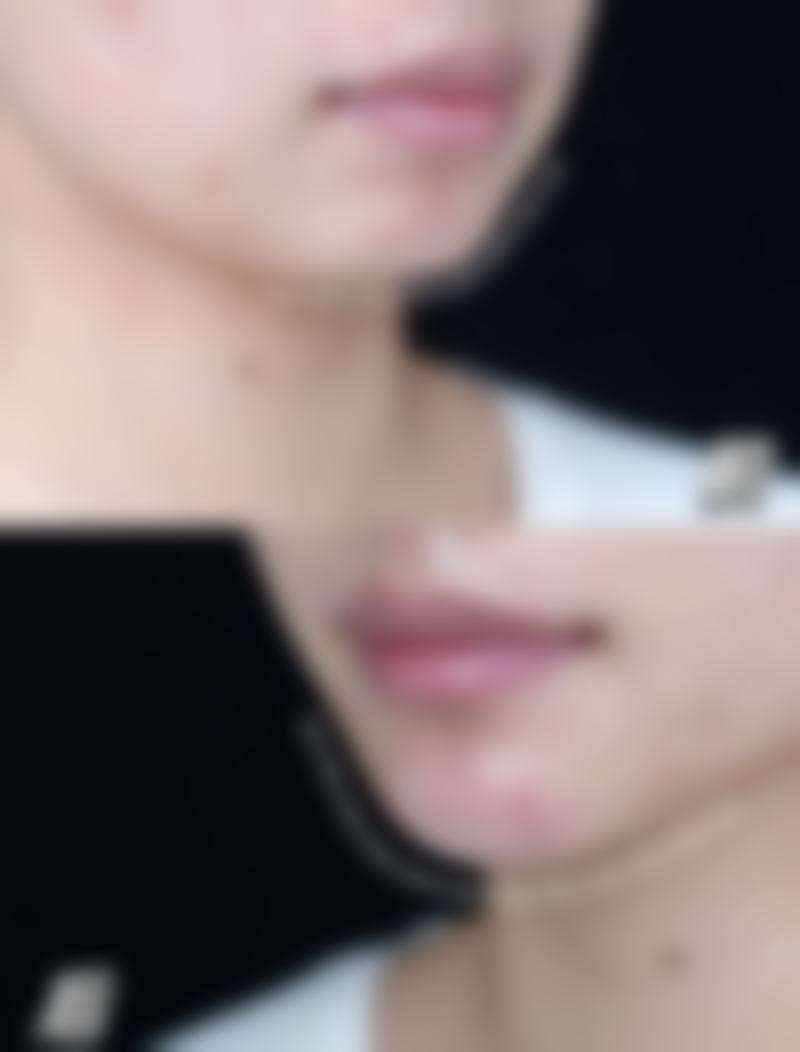 替代健康调整方案