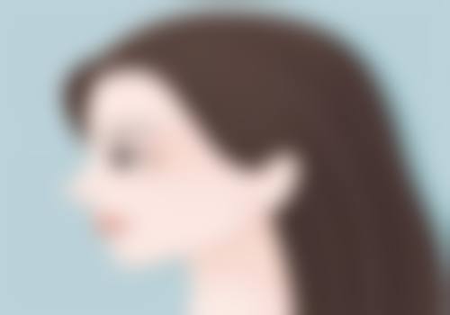 北京澄真医疗美容诊所张桦医生患者评价