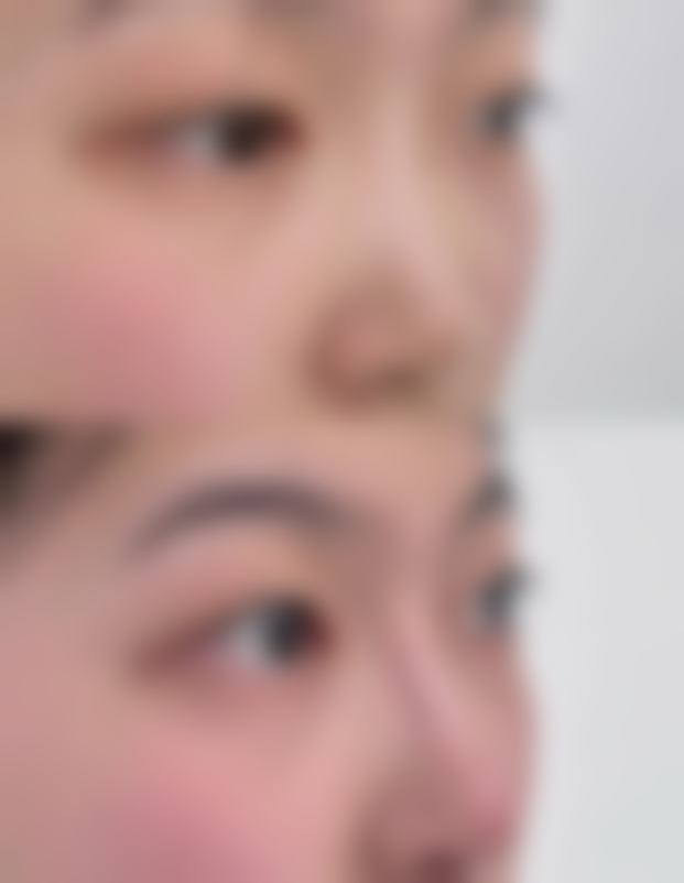 贵阳云岩雪雅医院整形美容科安景希医生预约挂号指南