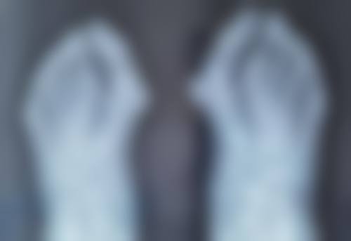 南昌韩美·宫廷生态软骨鼻3.0的研发背景和优势是什么？