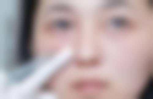 薛大大·五维精细化雕刻肋软骨生态鼻综合的手术流程是怎样的？