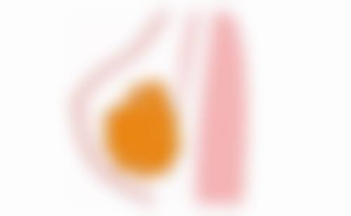 总结