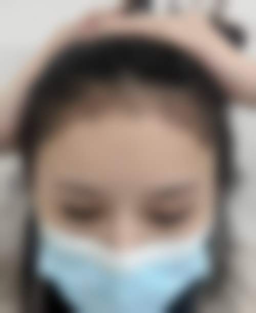 上海瑞丽诗植发医院口碑评价怎么样？