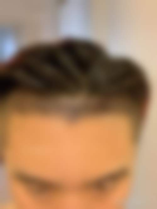 总结
