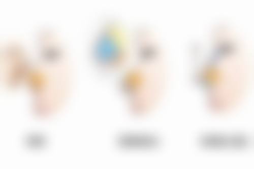 鼻综合手术适合什么样的人？