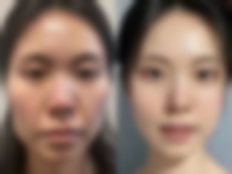 总结