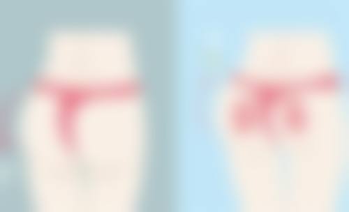 治疗疤痕疙瘩的核心原则是什么？