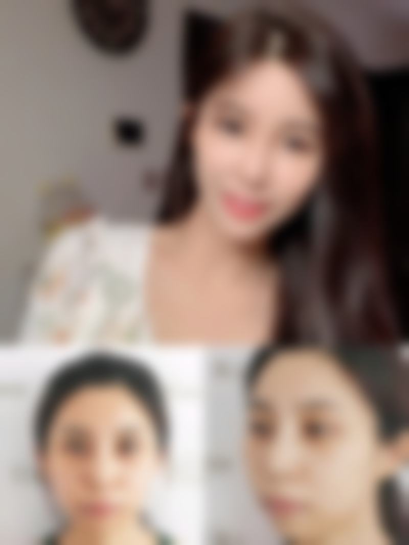 佛山东康整形美容门诊部正规吗？