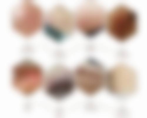 自体脂肪丰太阳穴安心吗？有什么优势和副作用？