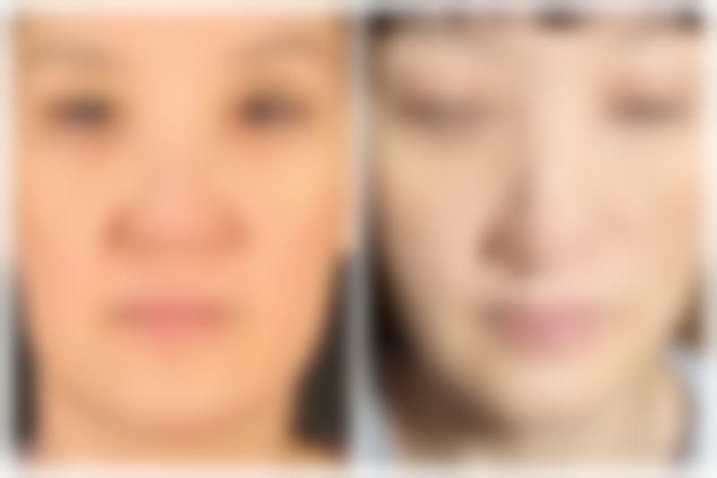 养护环境对通风有要求吗？