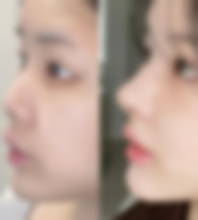 韩国普罗菲耳Profile整形外科医生介绍