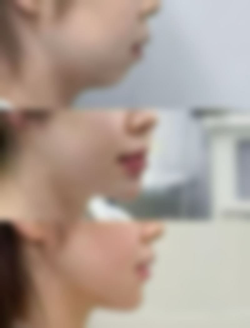 南昌鹏爱美容整形医院冯海涛医生皮肤美容技术怎么样？