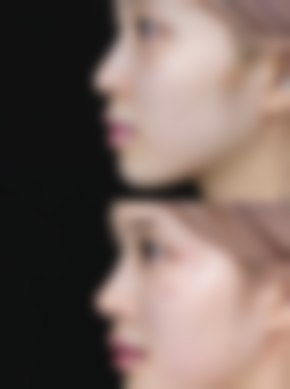 连云港美缔医疗美容口碑评价怎么样？