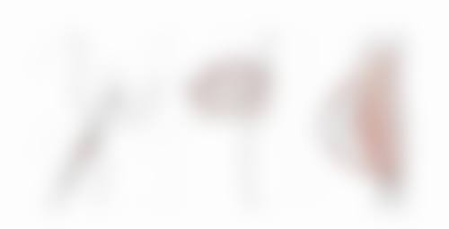 总结