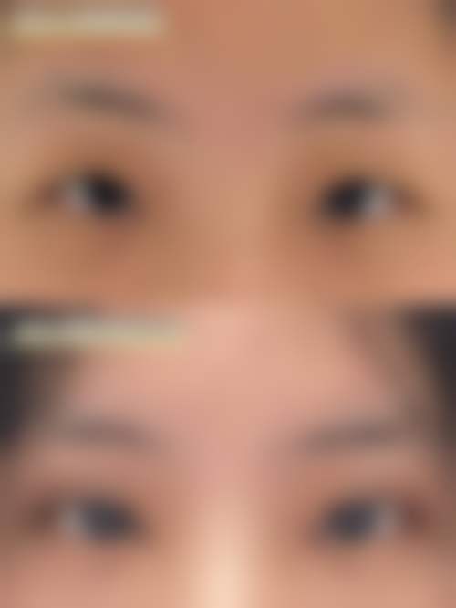 唐山张小熊医疗美容诊所王飏医生擅长项目