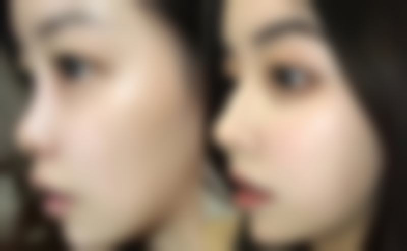 杭州颜久生医疗美容诊所赵卿医生收费价格