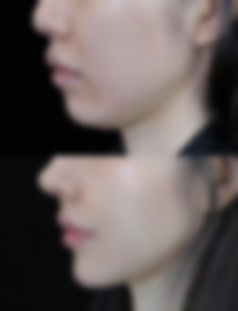 总结