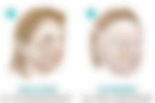 南宁伊莱美医疗美容门诊部卢祖初医生皮肤美容技术怎么样?