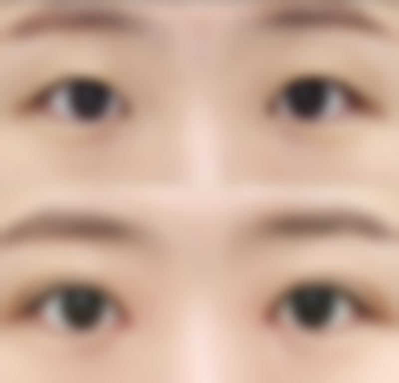 手术前需要做哪些准备工作呢？