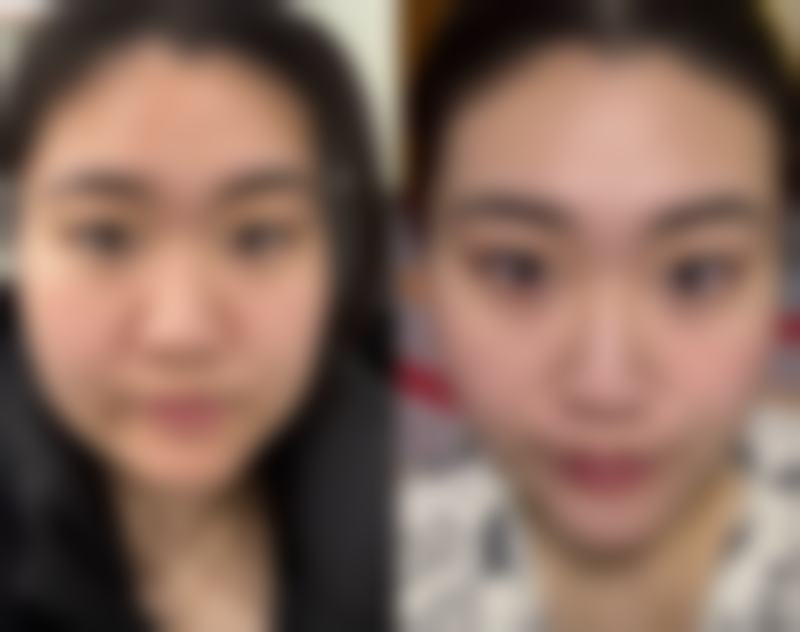成都高新柏薇整形医院正规吗？