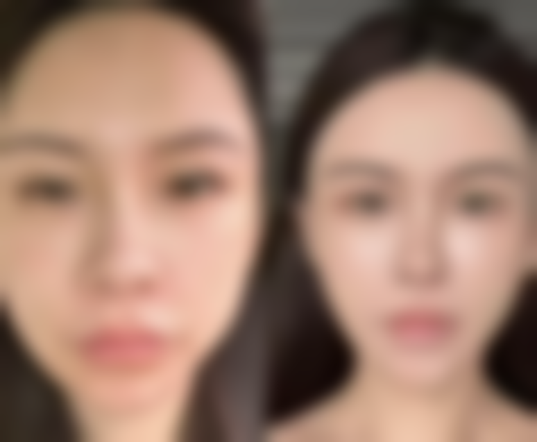 宜昌华美整形美容医院罗广杰医生患者评价