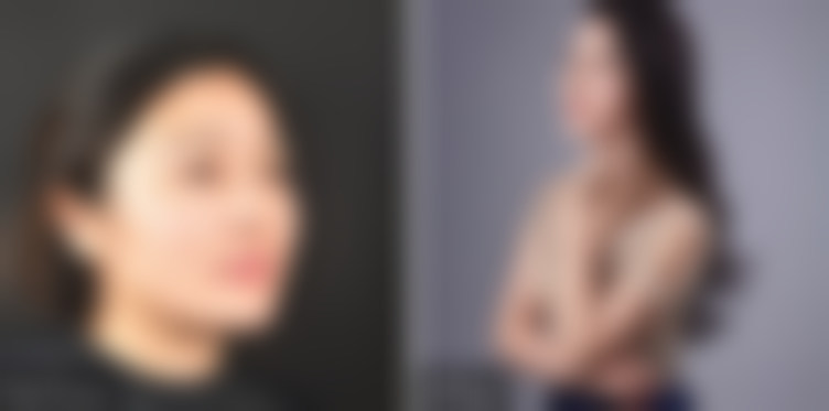 成都天使之翼医学美容医院唇部冰点脱毛适合哪些人?