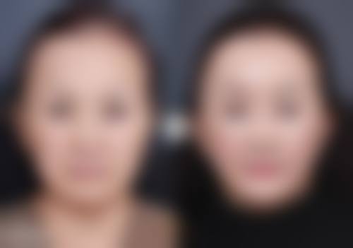 医美进阶方案有哪些呢？成效如何？