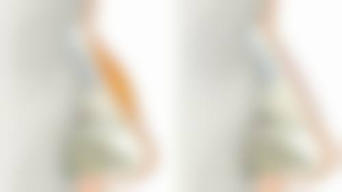 肋骨隆鼻多少天消肿？术后恢复周期全解析，做好这3步科学护理消肿更安心！一般1-2周基本消肿！ 