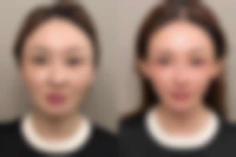 容貌、气场与间接运势关联:割双眼皮如何间接影响运势?