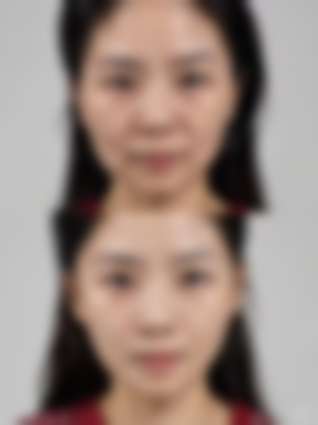 总结
