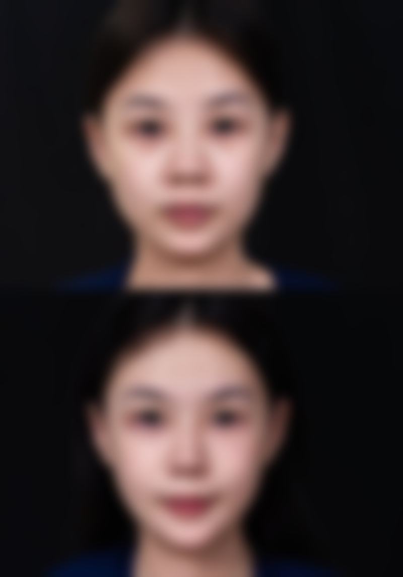 邯郸都市医疗美容医院口碑评价怎么样?