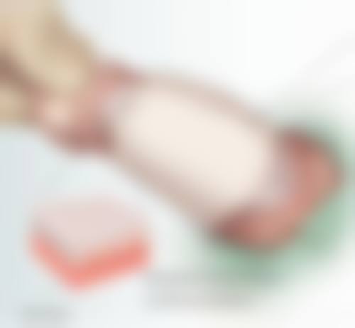 手术治疗有什么特别需要注意的地方吗?