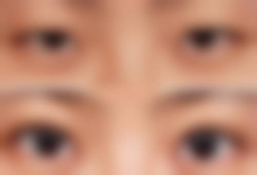 北京和颜一美轻医美连锁(国贸院)口碑评价怎么样?