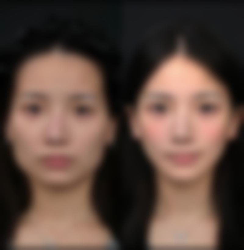 哈尔滨禾力康医疗美容医院刘亚春医生社会职称