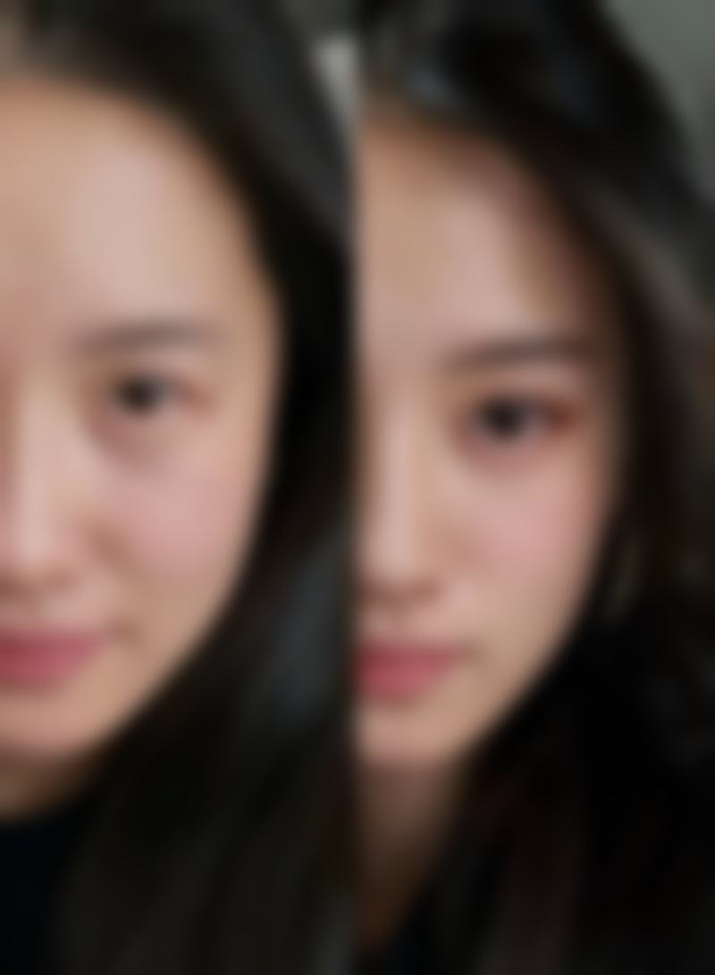 假体隆胸能管一辈子吗？医美专家详解：10 - 15年更换周期与4项科学护理指南，效果究竟咋样？ 