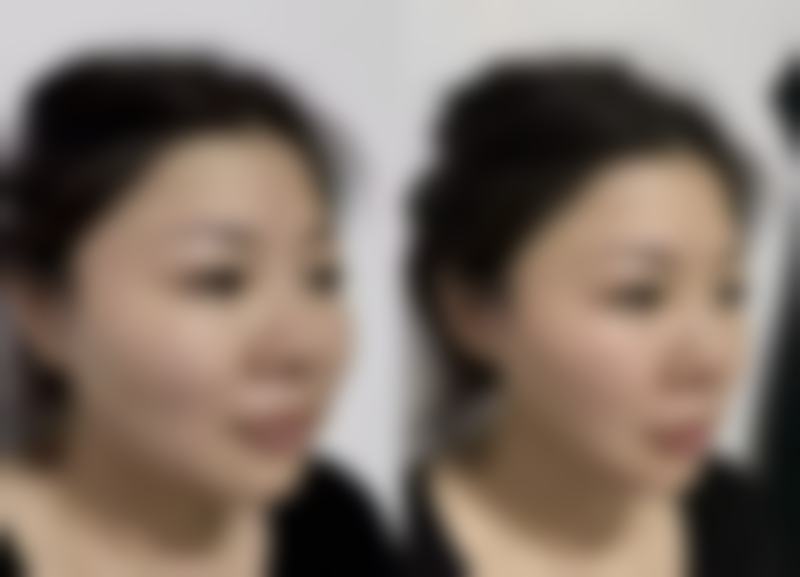 除了医美方案,日常护理和基础调理有哪些方法呢?