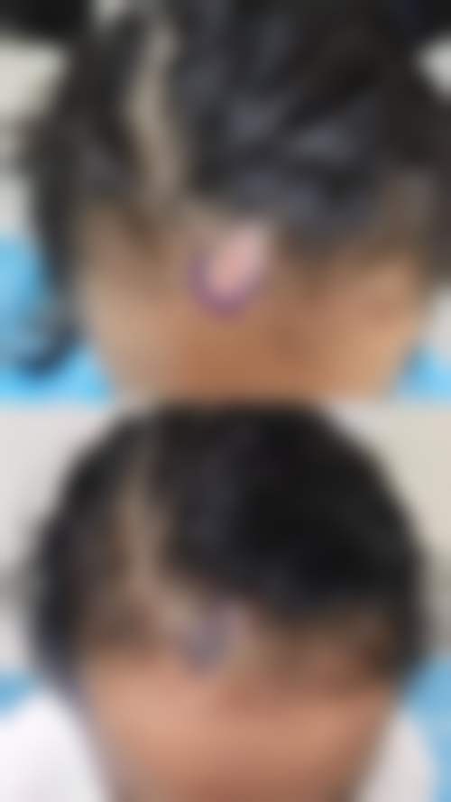 扬州俏华美医疗美容诊所无针水光仅需99元起，焕活肌肤让你拥有水润透亮美肌 