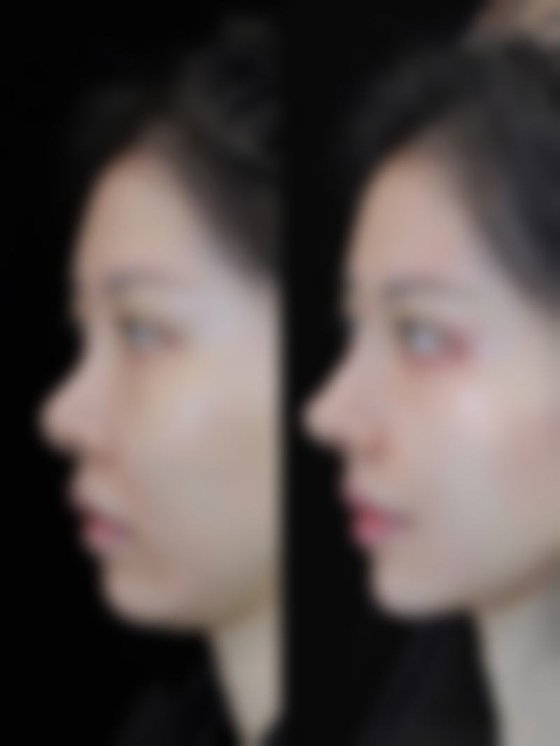 金华武义县第一人民医院整形美容科口碑评价怎么样?