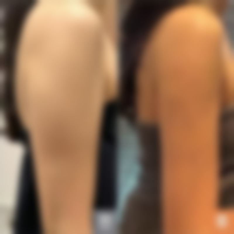 日常护理和修复管理要怎么做呢?