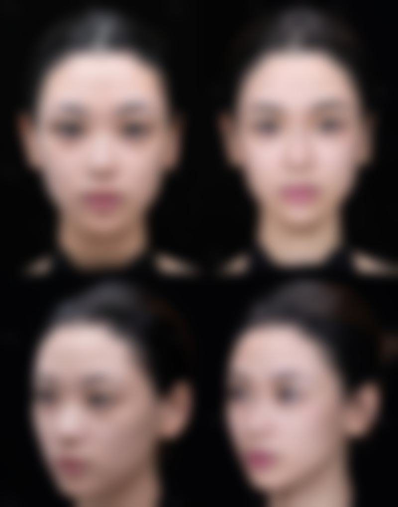 哈尔滨华运医疗美容整形口碑评价怎么样?