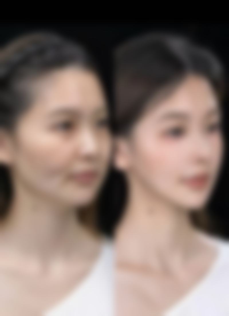 韩国Flora整形外科金仁哲医生擅长项目