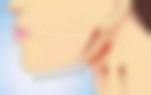 真相五:哪些人不适合进行割双眼皮手术?