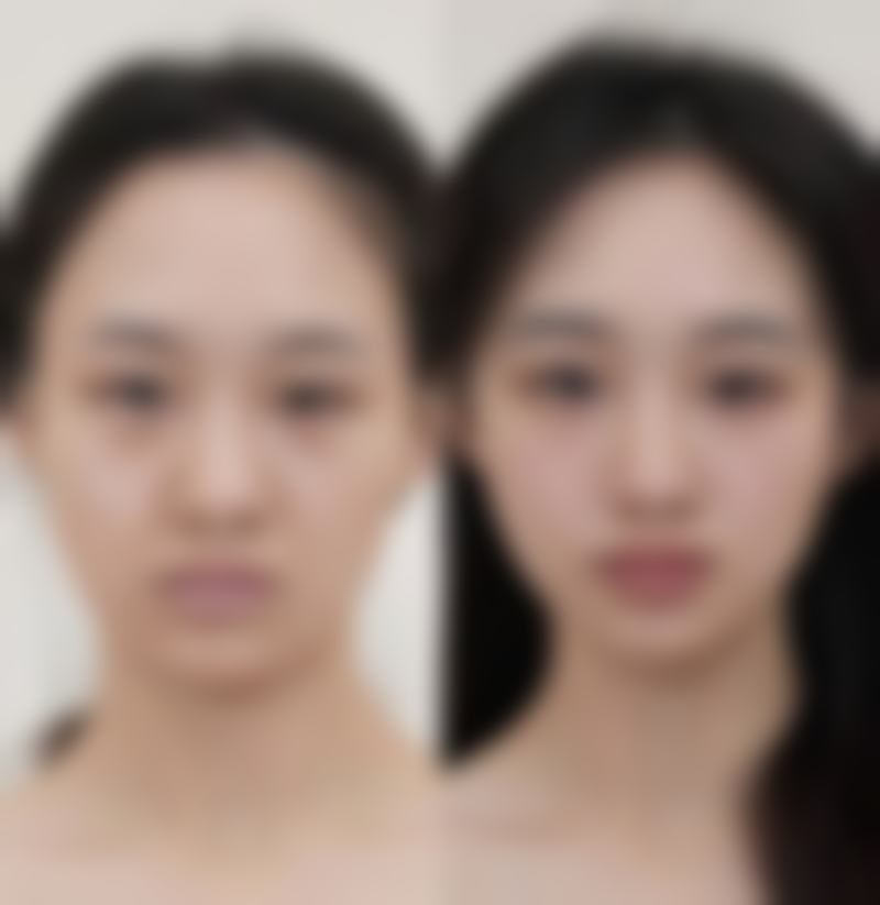 韩国dicarat皮肤科口碑评价怎么样?