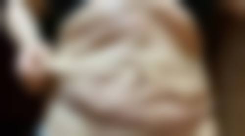 佳木斯李景林整形美容诊所口碑评价怎么样?