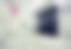 上饶信州维多利亚医疗美容门诊部丁爵敏医生自体软骨隆鼻技术怎么样?