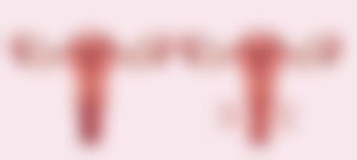 真相三:不同术式的手术去眼袋有什么特有副作用吗?