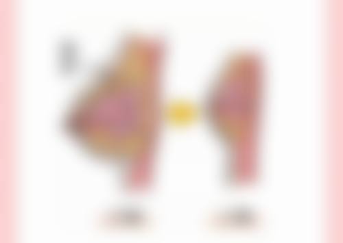 梅州爱丽诺医疗美容门诊部口碑评价怎么样?