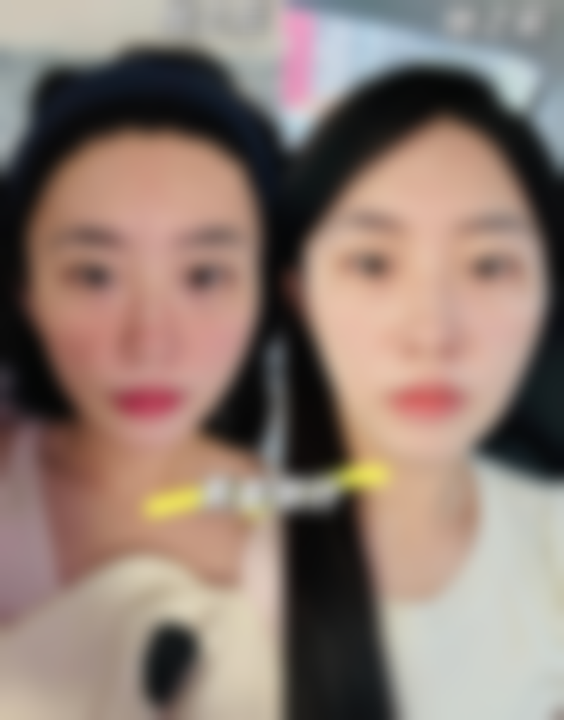 老年阶段做眼袋手术需要注意什么?
